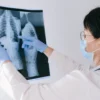 Professionnel de santé examinant une radiographie, mettant l'accent sur le diagnostic et l'examen médical