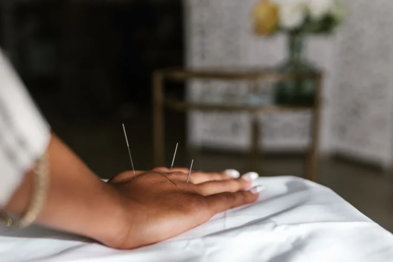 L&rsquo;acupuncture : principes, indications et efficacité