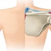Le bord médial de la scapula : anatomie, fonctions et pathologies