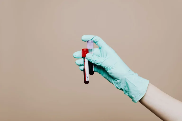 Cholestérol élevé : comprendre et traiter
