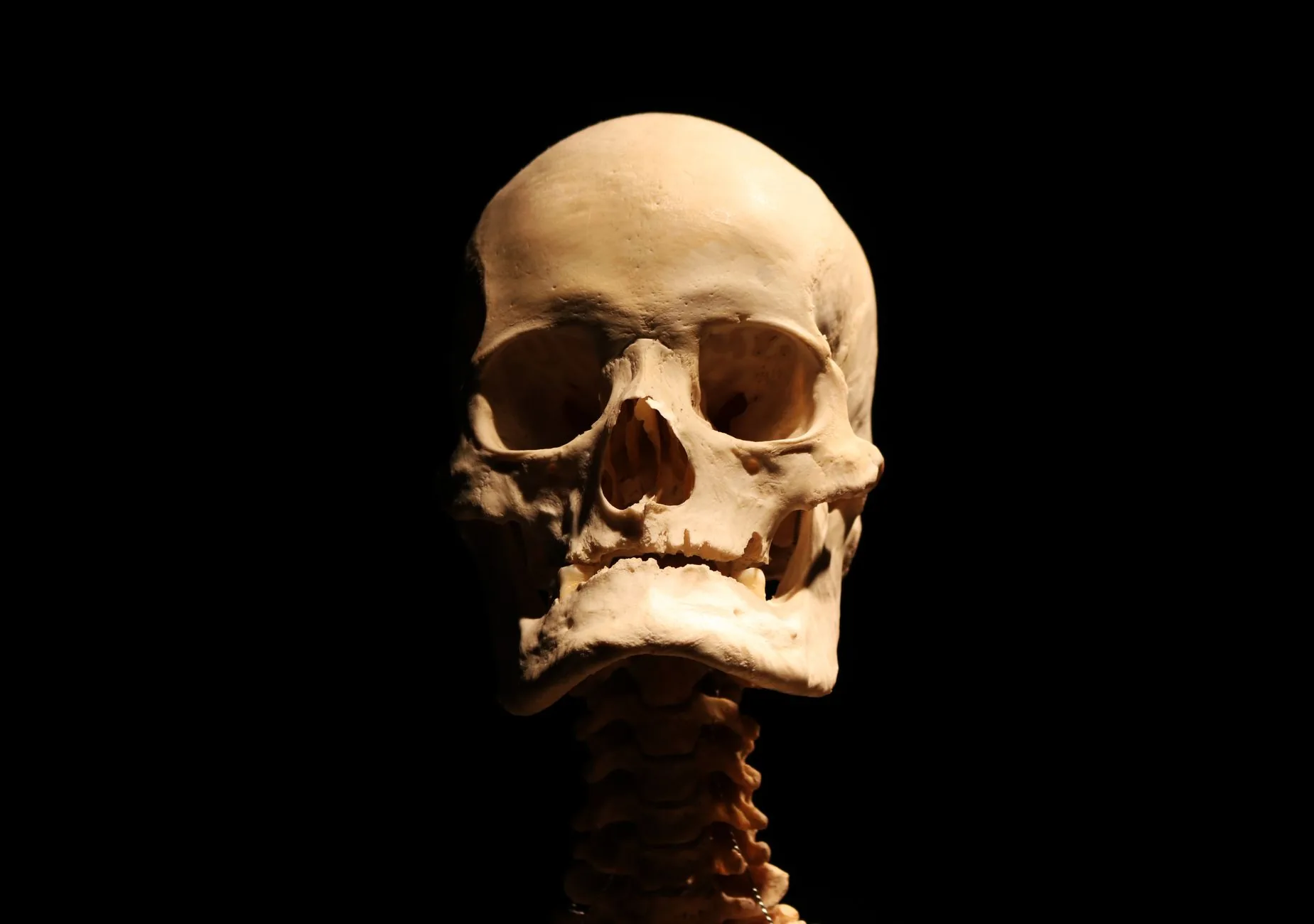 Le crâne et l’os frontal : anatomie et pathologies