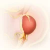 Le rete testis : anatomie, fonctions et pathologies de ce réseau tubulaire essentiel