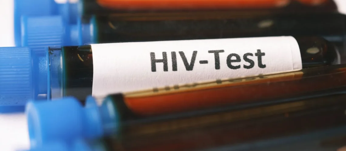 Image détaillée en gros plan montrant des échantillons de sang étiquetés pour un test de dépistage du VIH