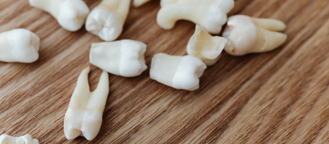 Gros plan détaillé sur plusieurs dents humaines extraites, disposées sur une surface en bois.