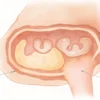 Les tubes séminifères : anatomie, fonctionnement et pathologies