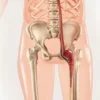 Ligament rond de la hanche : anatomie, rôles et pathologies