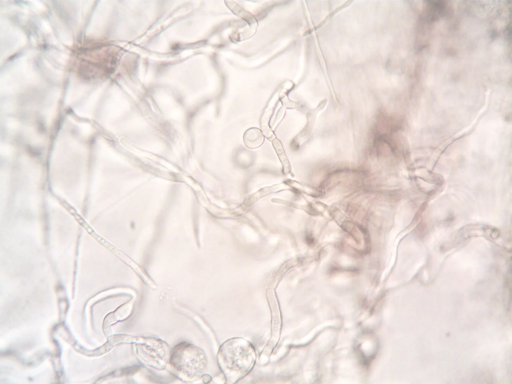 Microsporum : le champignon dermatophyte des teignes