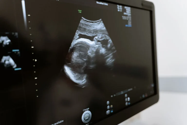 Môle hydatiforme : causes, symptômes et traitement complet