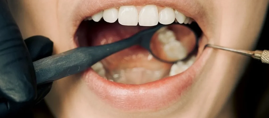 Gros plan d'un examen dentaire avec équipement moderne, illustrant le maintien de l'hygiène bucco-dentaire