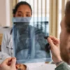 Médecin examinant une radiographie pulmonaire avec un patient dans un cabinet médical.