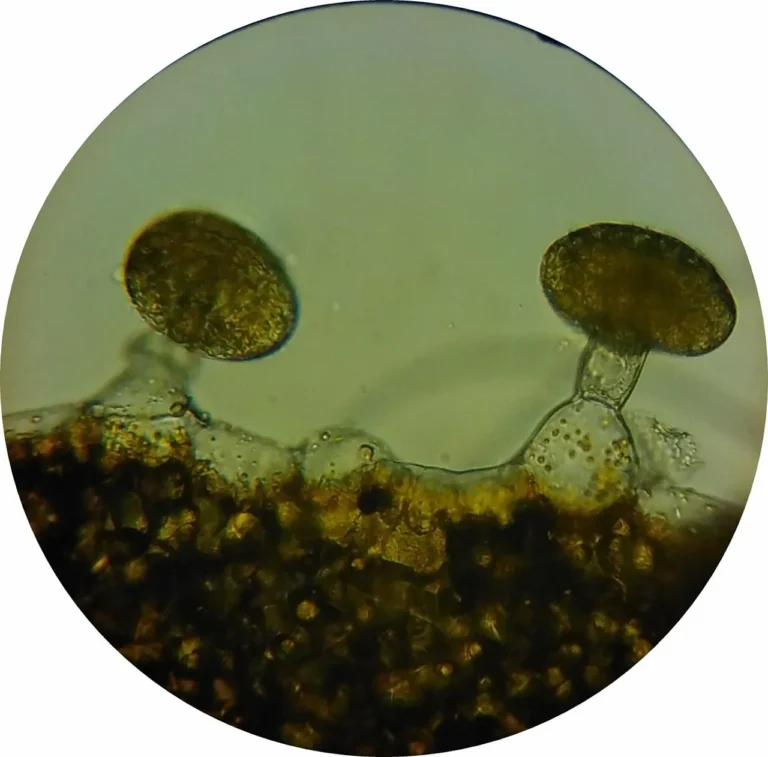 Rhizopus : comprendre le champignon de la mucormycose
