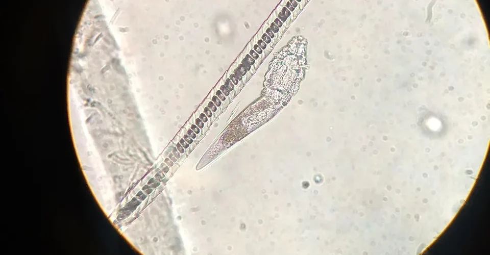 Schistosoma mansoni : comprendre la bilharziose intestinale