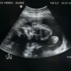 Échographie montrant l'image d'un enfant à naître dans l'utérus, illustrant grossesse et santé.