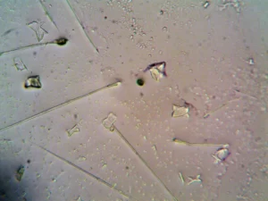 Shigella : la bactérie de la dysenterie