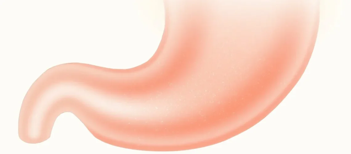 Sucralfate : le protecteur de la muqueuse gastrique pour la prévention des ulcères