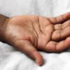 Varicelle et zona : comprendre et traiter l'infection par le virus varicelle-zona (VZV)