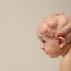 Anencéphalie : comprendre cette malformation neurologique grave