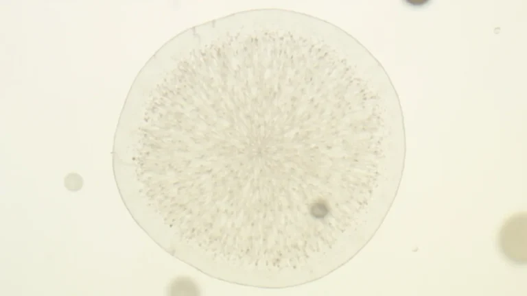 Aspergillus fumigatus : comprendre ce champignon pathogène