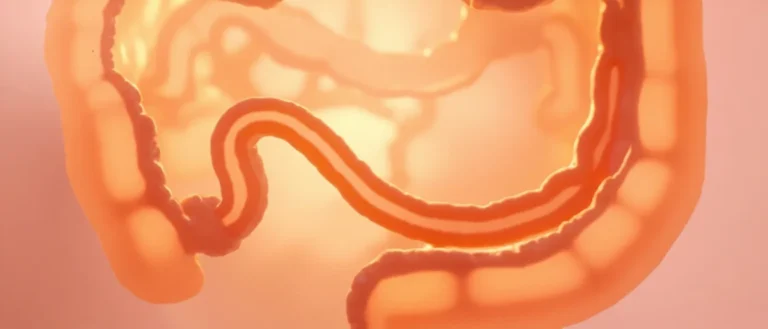 Cancer de l&rsquo;intestin grêle : causes et symptômes