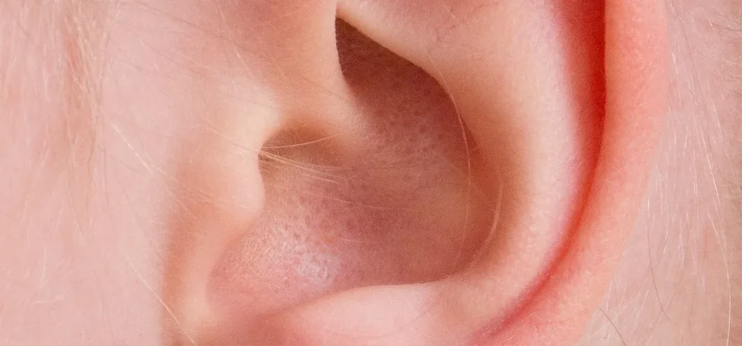 Chondrite auriculaire : causes, symptômes et traitements