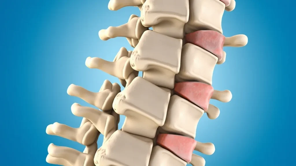 Douleur facettaire : comprendre, diagnostiquer et soulager l’arthrose des articulations vertébrales : vue générale