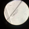 Fasciola hepatica : comprendre la douve du foie, diagnostic et traitement
