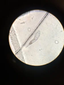 Fasciola hepatica : comprendre la douve du foie