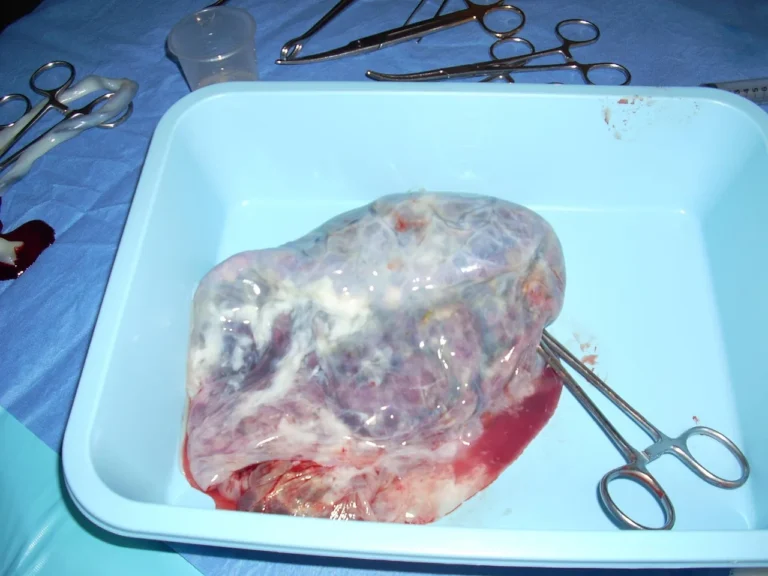 Formation du placenta : son développement in utero