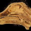 La cavité nasale : anatomie, fonctions et pathologies courantes