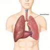 La Plèvre Viscérale : Anatomie, Fonctions et Pathologies Associées