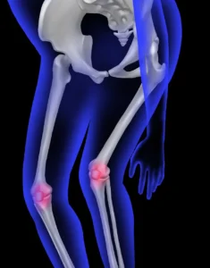 Le tibia : anatomie et pathologies