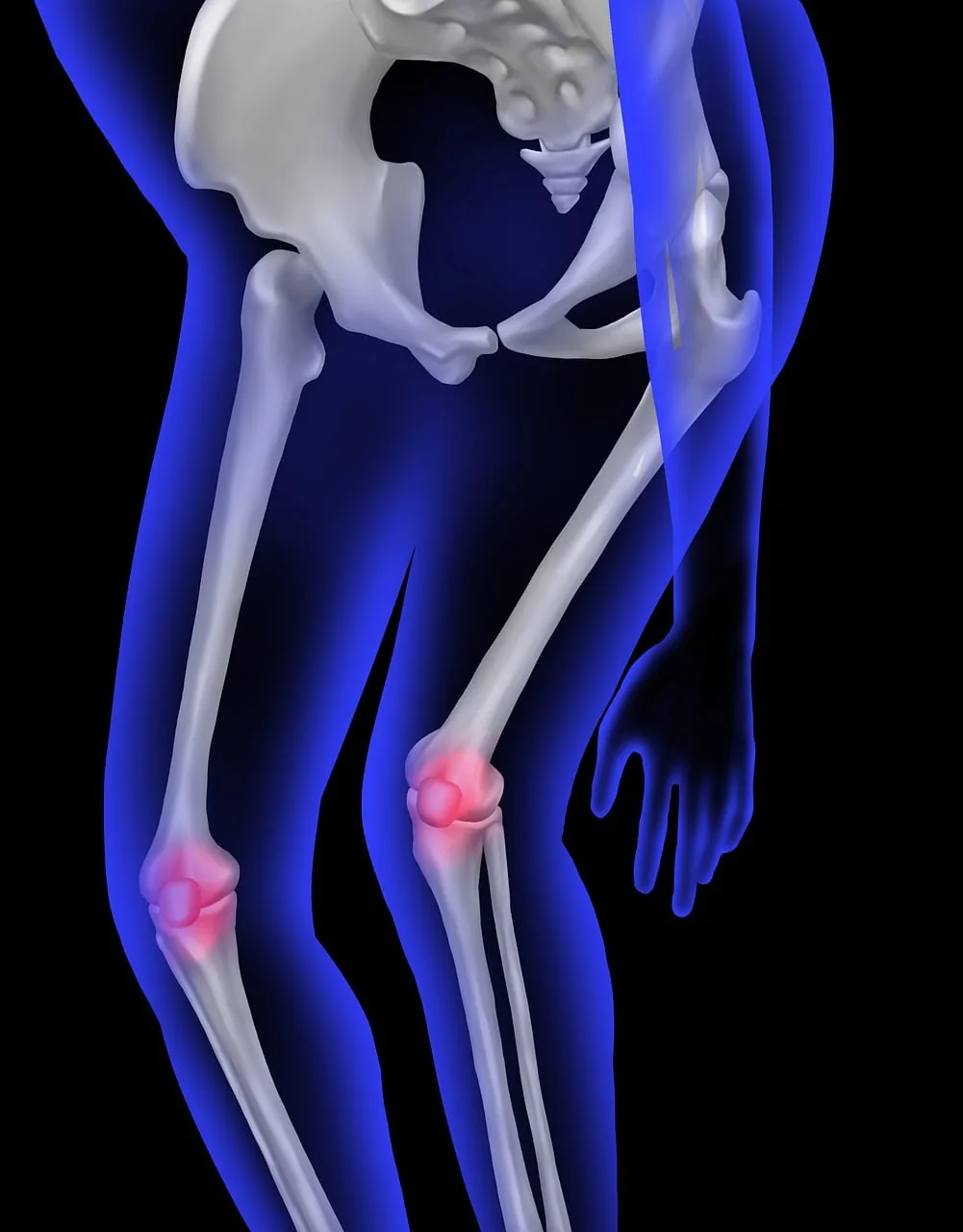 Le tibia : anatomie et pathologies