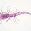 Leptospira interrogans : la bactérie responsable de la leptospirose