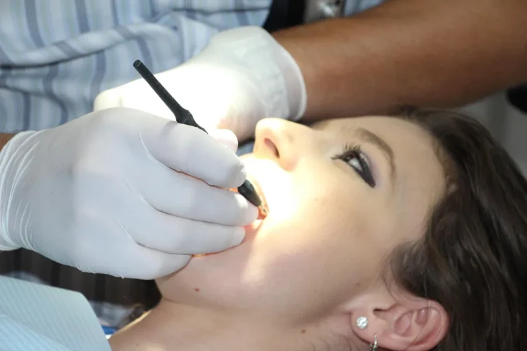 Les molaires de sagesse : anatomie, troubles et extraction