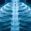 Les muscles subcostaux : anatomie, fonction et importance clinique