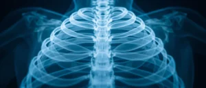 Les muscles subcostaux : anatomie et rôle clinique