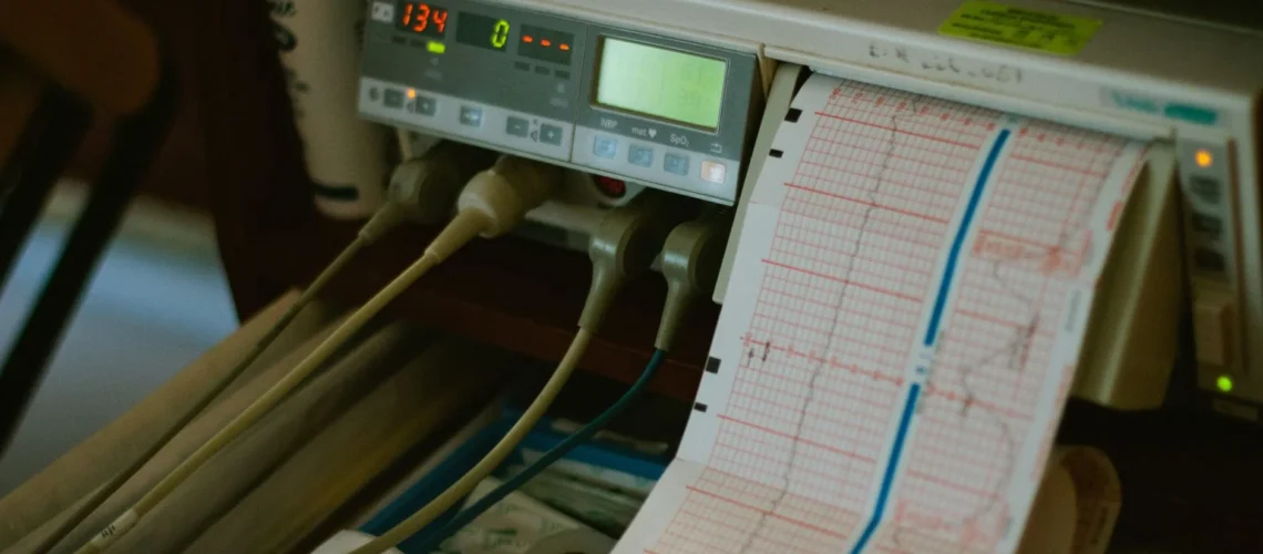 Gros plan d'un électrocardiogramme affichant la fréquence cardiaque dans un hôpital.