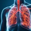 Vascularite pulmonaire : causes, symptômes, diagnostic et traitements